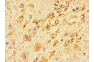 Immunohistochemistry of paraffin-embedded human placenta tissue using ABIN7146737 at dilution of 1:100 (CA11 anticorps  (AA 24-328))