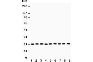 Western blot testing of PRDX1 antibody and Lane 1:  rat brain;  2: mouse brain;  3: human U87;  4: (m) Neuro-2a;  5: (h) A375;  6: (h) 293T;  7: (h) SMMC;  8: (h) A549;  9: (h) RH35 lysate. (Peroxiredoxin 1 anticorps  (Middle Region))