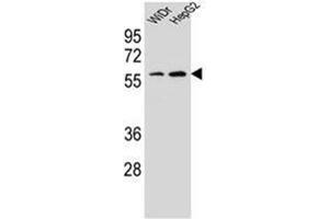 Western blot analysis of HOXA10 / HOX1H Antibody (Center) in WiDr, HepG2 cell line lysates (35ug/lane). (HOXA10 anticorps  (Middle Region))