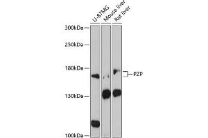Western blot analysis of extracts of various cell lines, using PZP antibody (ABIN1682416, ABIN3017699, ABIN3017700 and ABIN6220213) at 1:3000 dilution. (PZP anticorps  (AA 620-740))