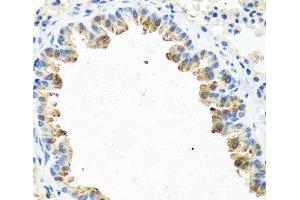 Immunohistochemistry of paraffin-embedded Mouse lung using GNRH2 Polyclonal Antibody at dilution of 1:100 (40x lens). (GnRH2 anticorps)