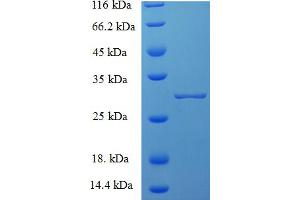 SDS-PAGE (SDS) image for Chymase 1, Mast Cell (CMA1) (AA 22-146), (partial) protein (His tag) (ABIN5709297)