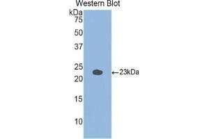 Detection of Recombinant GaA, Mouse using Polyclonal Antibody to Glucosidase Alpha, Acid (GaA) (GAA anticorps  (AA 755-953))
