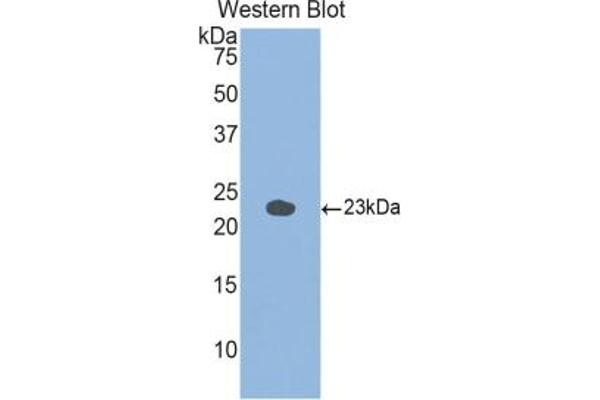 GAA anticorps  (AA 755-953)