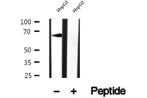 Western blot analysis of extracts of HepG2 cells, using RNF156 antibody. (Mahogunin RING Finger Protein 1 anticorps  (Internal Region))