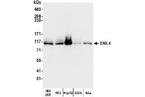 Western Blotting (WB) image for anti-Echinoderm Microtubule Associated Protein Like 4 (EML4) (AA 931-981) antibody (ABIN7454794) (EML4 anticorps  (AA 931-981))
