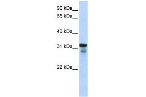LAPTM4B antibody used at 1 ug/ml to detect target protein. (LAPTM4B anticorps  (Middle Region))