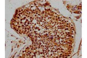 IHC image of ABIN7176072 diluted at 1:300 and staining in paraffin-embedded human testis tissue performed on a Leica BondTM system. (ZIM2 anticorps  (AA 1-124))