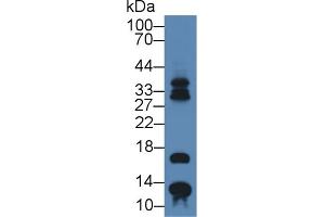 Detection of S100A7 in Bovine Pancreas lysate using Polyclonal Antibody to S100 Calcium Binding Protein A7 (S100A7) (S100A7 anticorps  (AA 1-101))