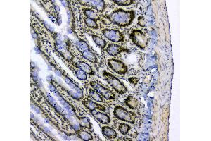 IHC analysis of splicing factor 1 using anti-splicing factor 1 antibody .