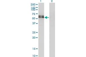 Western Blot analysis of ACVR1 expression in transfected 293T cell line by ACVR1 monoclonal antibody (M07), clone 2D5.