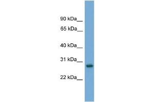 WB Suggested Anti-Abt1 Antibody Titration: 0. (Activator of Basal Transcription 1 anticorps  (Middle Region))