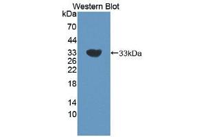 Figure. (CNN2 anticorps  (AA 1-269))
