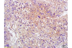 L1 human colon carcinoma lysates L2 rat brain lysates probed with Anti GPR15 Polyclonal Antibody, Unconjugated (ABIN702835) at 1:200 overnight at 4 °C. (GPR15 anticorps  (AA 51-150))