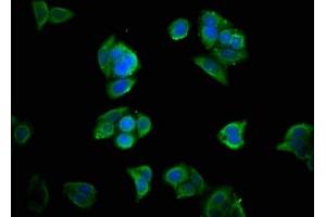 Immunofluorescence staining of PC-3 cells with ABIN7155709 at 1:33, counter-stained with DAPI.