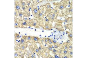 Immunohistochemistry of paraffin-embedded human liver injury using ABAT antibody (ABIN5973045) at dilution of 1/100 (40x lens).