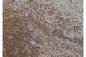 ABIN6273485 at 1/100 staining Human spleen tissue by IHC-P. (MAGED4B anticorps  (Internal Region))