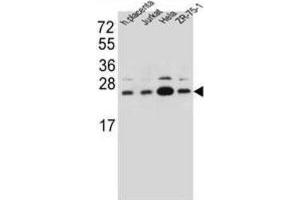 Western Blotting (WB) image for anti-Signal Sequence Receptor, beta (Translocon-Associated Protein Beta) (SSR2) antibody (ABIN2997190)