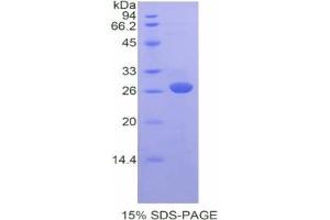 SDS-PAGE analysis of Mouse FATP5 Protein. (SLC27A5 Protéine)