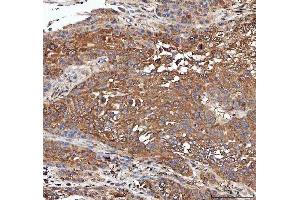 IHC analysis of PPP2CA using anti-PPP2CA antibody (ABIN3043356). (PPP2CA anticorps  (AA 1-309))