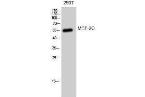 Western Blotting (WB) image for anti-Myocyte Enhancer Factor 2C (MEF2C) (Ser893) antibody (ABIN3185513) (MEF2C anticorps  (Ser893))