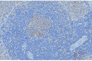 ABIN6276985 at 1/100 staining Human lymph node tissue by IHC-P. (PGK1 anticorps  (Internal Region))