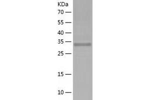 Western Blotting (WB) image for Ribosomal Protein, Large, P0 (RPLP0) (AA 1-317) protein (His tag) (ABIN7124909)