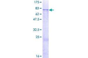 Image no. 1 for AarF Domain Containing Kinase 1 (ADCK1) (AA 1-523) protein (GST tag) (ABIN7565569)