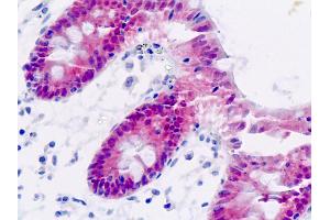 Human, Colon: Formalin-Fixed Paraffin-Embedded (FFPE) (AKR7A3 anticorps)