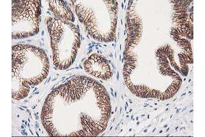 Image no. 13 for anti-Catenin (Cadherin-Associated Protein), beta 1, 88kDa (CTNNB1) antibody (ABIN1496889)