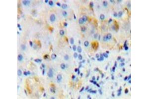 Used in DAB staining on fromalin fixed paraffin-embedded Liver tissue (Oncostatin M Receptor anticorps  (AA 503-749))
