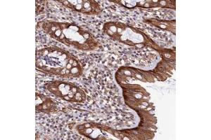 Immunohistochemical staining of human rectum with LEKR1 polyclonal antibody  shows strong cytoplasmic positivity in glandular cells at 1:1000-1:2500 dilution. (LEKR1 anticorps)