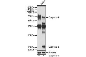 Western blot analysis of extracts of Jurkat cells, using Caspase-8 antibody (ABIN6131530, ABIN6137970, ABIN6137972 and ABIN6213676) at 1:1000 dilution.