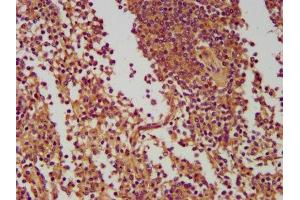 IHC image of ABIN7165873 diluted at 1:400 and staining in paraffin-embedded human spleen tissue performed on a Leica BondTM system.