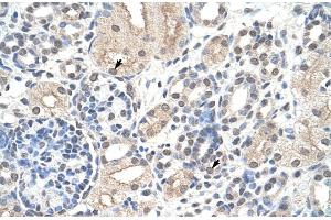 Rabbit Anti-NCL Antibody Catalog Number: ARP40583 Paraffin Embedded Tissue: Human Kidney Cellular Data: Epithelial cells of renal tubule Antibody Concentration: 4. (Nucleolin anticorps  (N-Term))