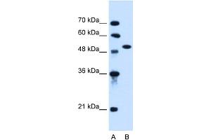 WB Suggested Anti-ACVR1 Antibody Titration:  0. (ACVR1 anticorps  (N-Term))