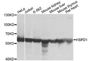 Western blot analysis of extracts of various cell lines, using HSPD1 antibody.