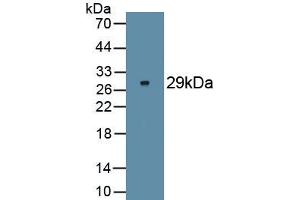 Detection of Recombinant FOXP3, Human using Monoclonal Antibody to Forkhead Box P3 (FOXP3) (FOXP3 anticorps  (AA 191-412))