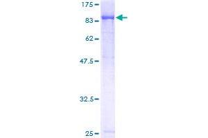 Image no. 1 for Transducin (Beta)-Like 3 (TBL3) (AA 1-808) protein (GST tag) (ABIN1322265)