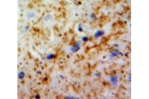 IHC-P analysis of Brain tissue, with DAB staining. (PLAUR anticorps  (AA 221-305))