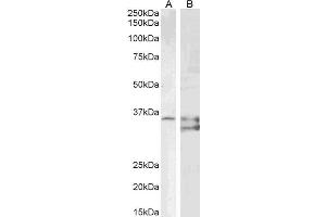 ABIN6391386 (1ug/ml) staining of PD19 (A) and (2µg/ml) K562 (B) cell lysate (35µg protein in RIPA buffer).