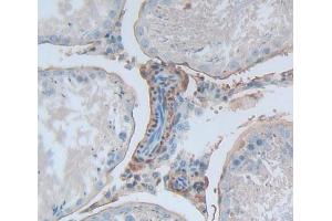 IHC-P analysis of Rat Tissue, with DAB staining. (TNC anticorps  (AA 175-342))
