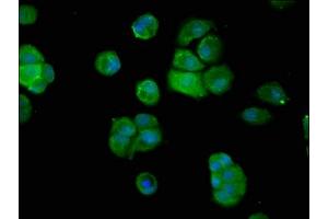 Immunofluorescence staining of MCF-7 cells with ABIN7144753 at 1:200, counter-stained with DAPI. (Aspartyl Aminopeptidase anticorps  (AA 279-386))