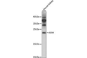 Western blot analysis of extracts of Mouse kidney, using ADM antibody (ABIN7265507) at 1:1000 dilution. (Adrenomedullin anticorps  (AA 50-150))
