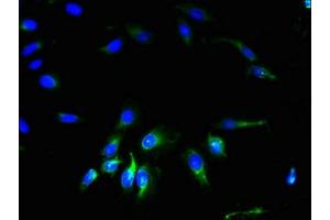 Immunofluorescent analysis of Hela cells using ABIN7153593 at dilution of 1:100 and Alexa Fluor 488-congugated AffiniPure Goat Anti-Rabbit IgG(H+L)