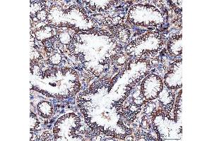 IHC analysis of Integrin alpha 3/ITGA3 using anti-Integrin alpha 3/ITGA3 antibody (ABIN7602696).