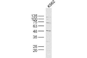 Human K562 cells probed with MAGEB6 Polyclonal Antibody, unconjugated  at 1:300 overnight at 4°C followed by a conjugated secondary antibody at 1:10000 for 90 minutes at 37°C. (MAGEB6 anticorps  (AA 151-250))