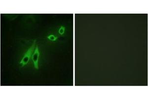 Immunofluorescence analysis of NIH/3T3 cells, using AKAP3 antibody. (AKAP3 anticorps  (Internal Region))