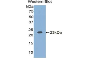 Western blot analysis of the recombinant protein. (IL1A anticorps  (AA 90-268))