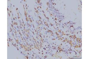 IHC analysis of EIF4A1 using anti-EIF4A1 antibody (ABIN7603144). (EIF4A1 anticorps  (N-Term))